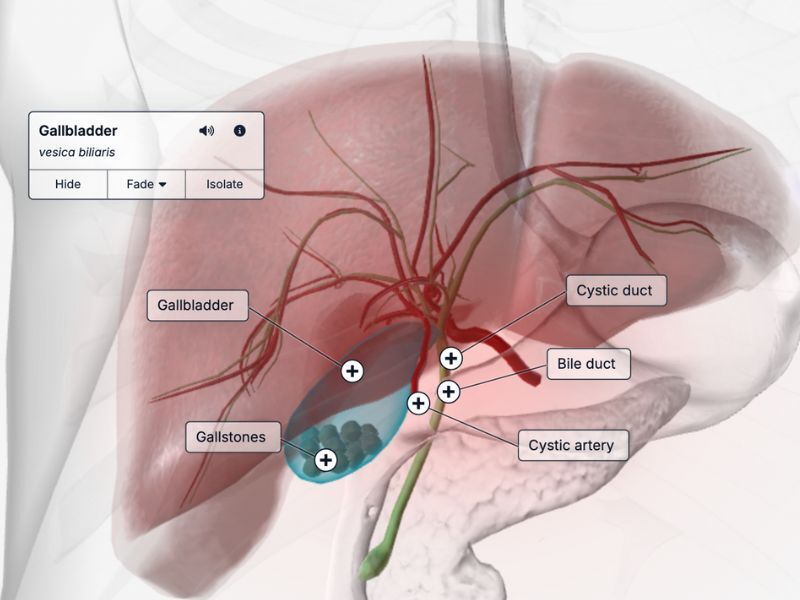 Interactive Cholecystectomy Model with Audio – BioDigital Studio for Clinical Instruction