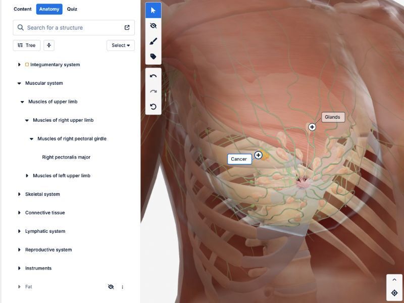 Customizable 3D Mastectomy Model with Dark Skin Tone – Patient Education Tool
